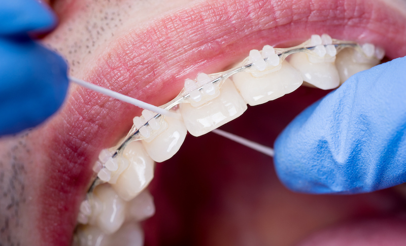 <br />
<b>Warning</b>:  Use of undefined constant SITENAME - assumed 'SITENAME' (this will throw an Error in a future version of PHP) in <b>/home/whiteloft/public_html/detalle.php</b> on line <b>76</b><br />
SITENAME